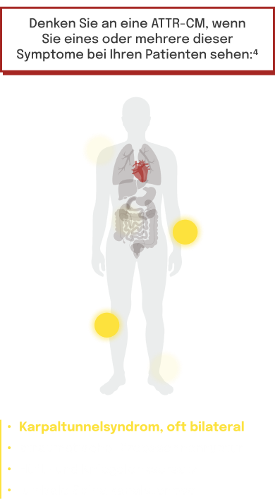 Frühe Symptomindikatoren, die häufig mit ATTR‑CM
assoziiert sind
