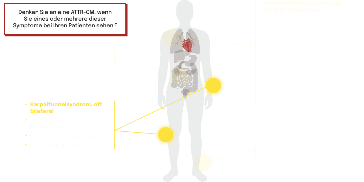 Frühe Symptomindikatoren, die häufig mit ATTR‑CM
assoziiert sind