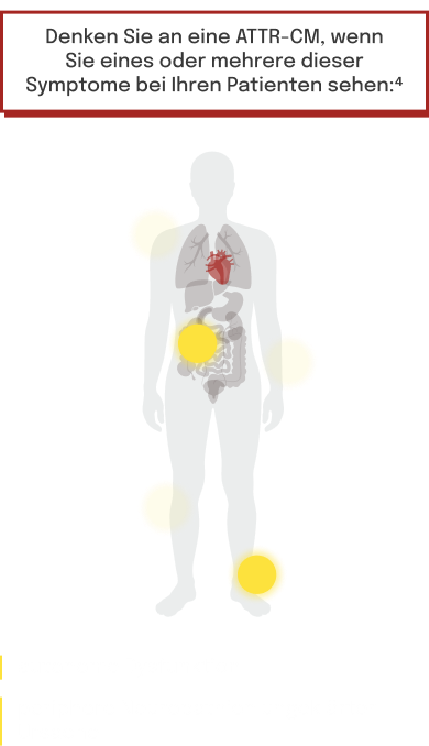 Körpergrafik mit hervorgehobenen
Symptombereichen, die häufig mit ATTR‑CM
assoziiert sind
